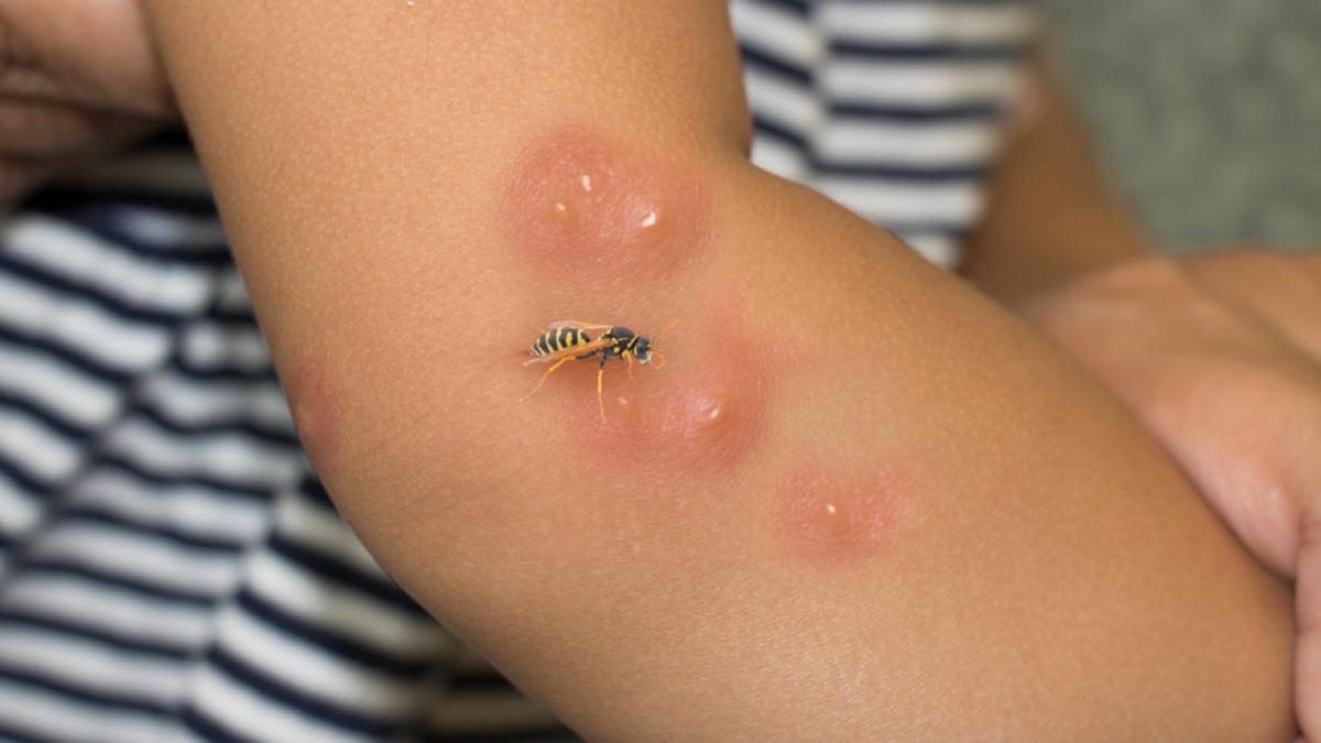 ABEJAS