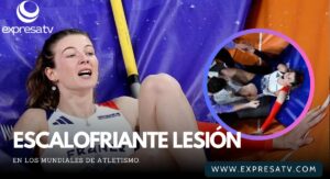 FRACTURA