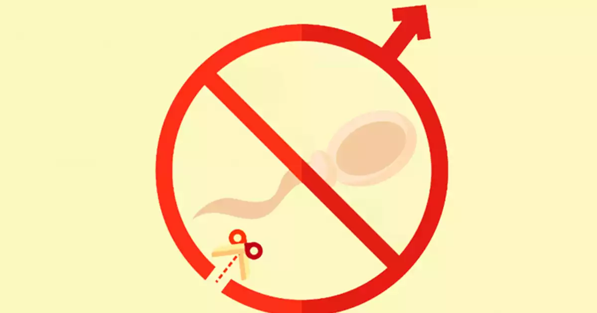 VASECTOMIA