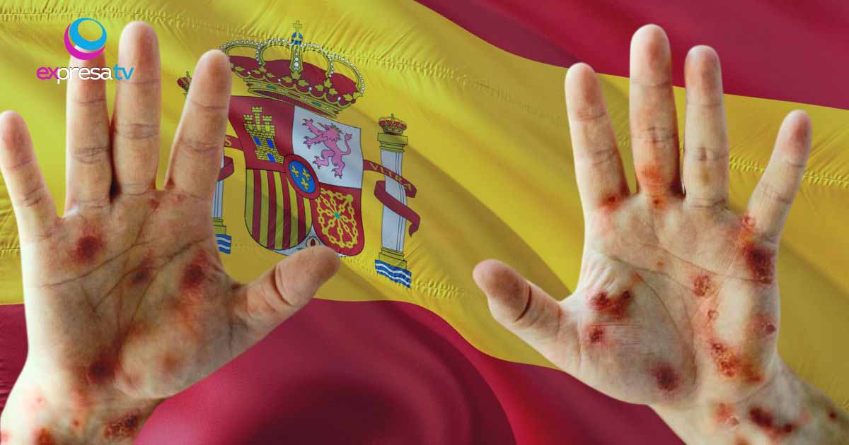 CASOS ESPAÑA