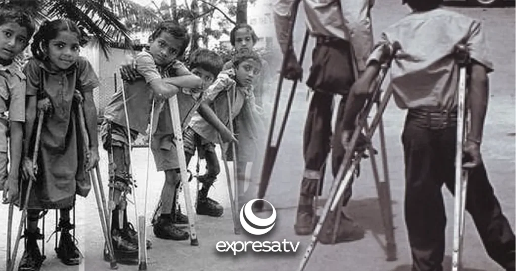 POLIO