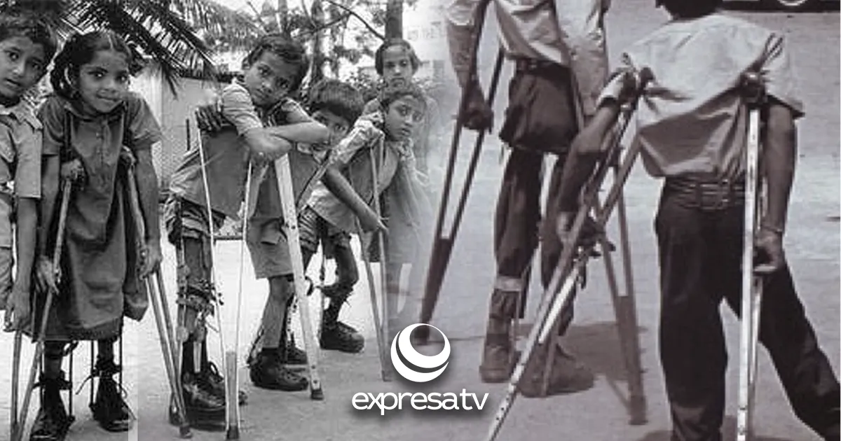 POLIO