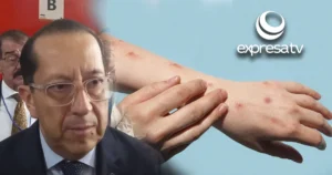SARAMPIÓN